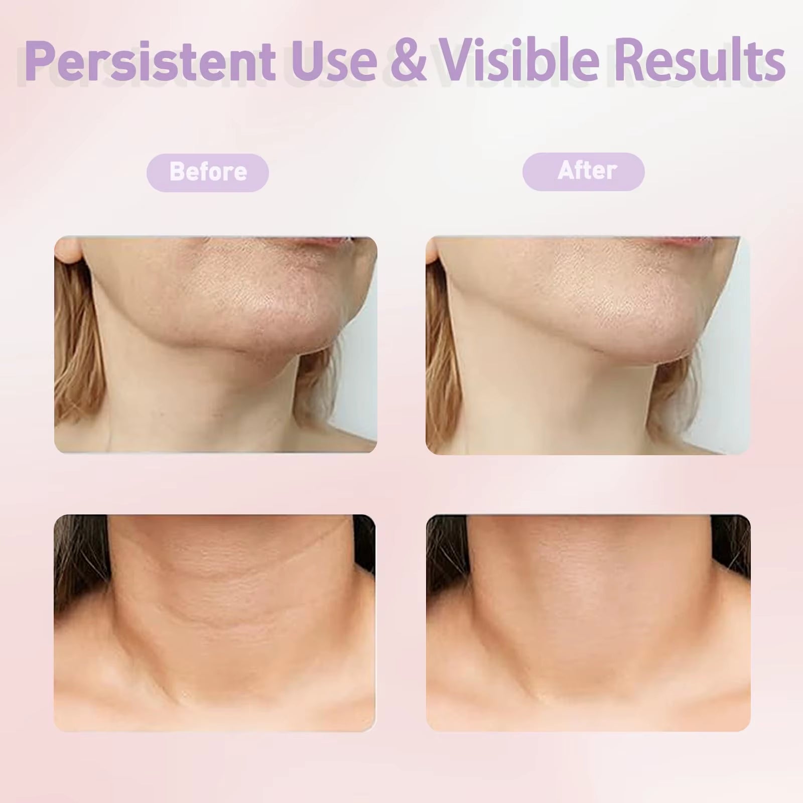 EMS Neck Face Lifter Neck Face Lifting Massager Skin Tighten Device Led Photon Therapy anti Wrinkle Double Chin Remover