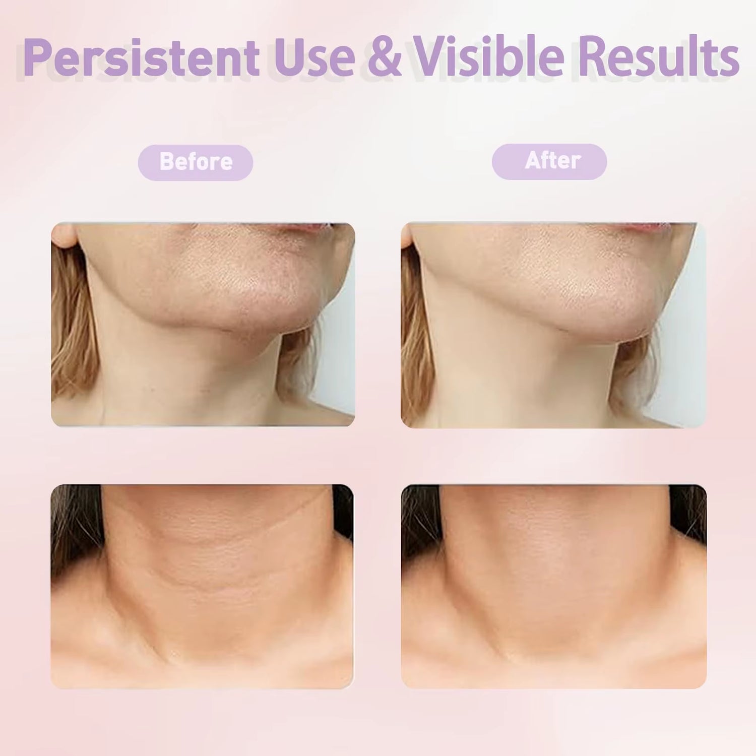EMS Neck Face Lifter Neck Face Lifting Massager Skin Tighten Device Led Photon Therapy anti Wrinkle Double Chin Remover